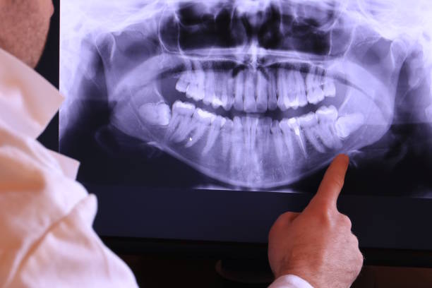 Best Emergency Care for Gum Disease in Pocahontas, AR