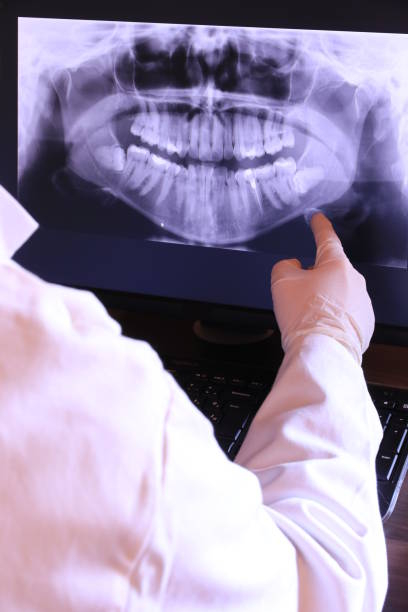 Best Emergency Wisdom Tooth Extraction in Pocahontas, AR